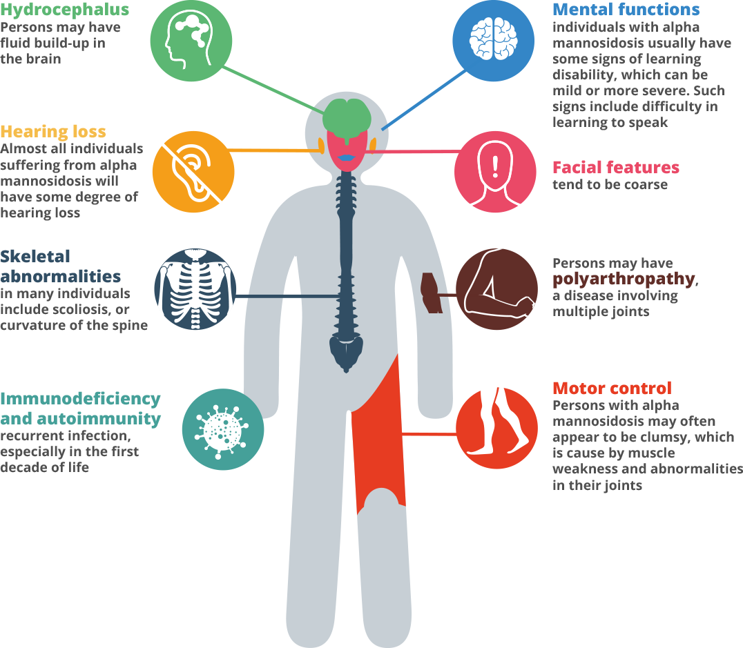 Alpha Mannosidosis symptoms