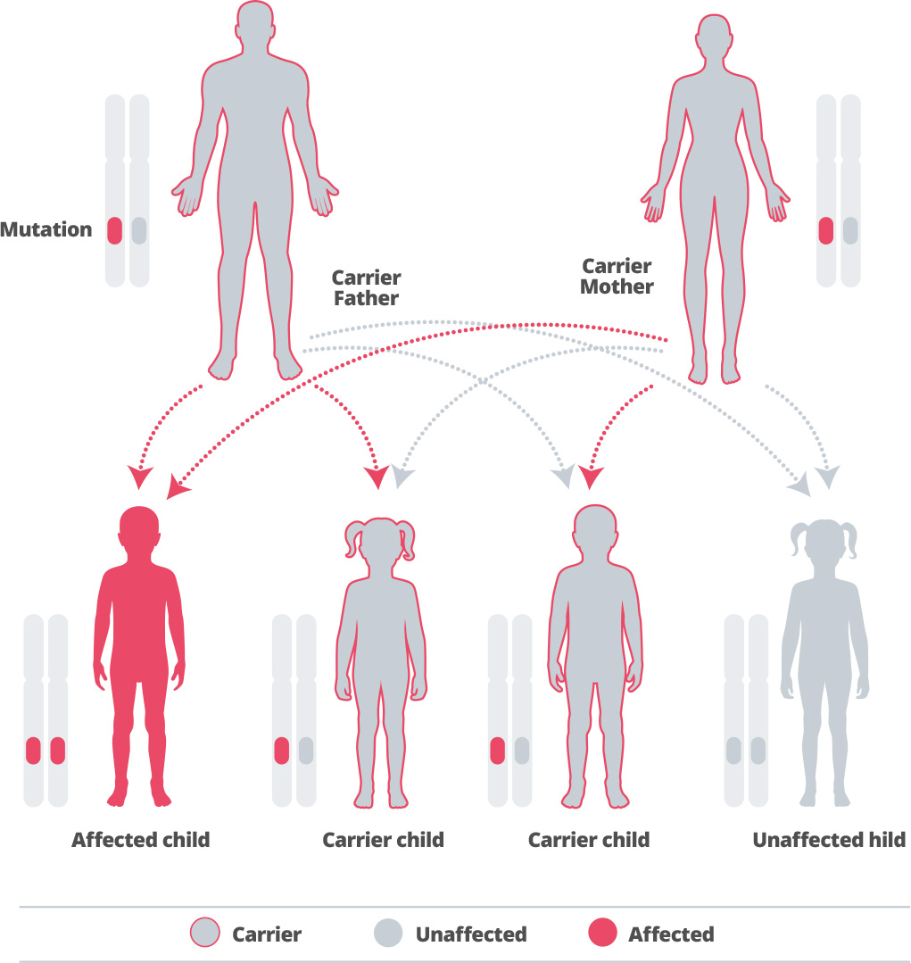 Alpha Mannosidosis diagnosis